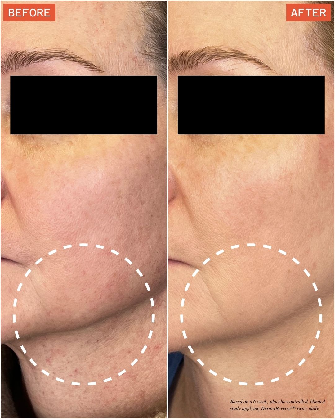 DermaReverse™: Clinically-Proven Skincare for GLP-1 Users