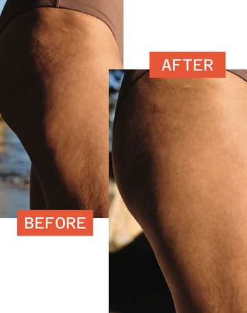 Skin Tightening + SPF30 with DermaTight™