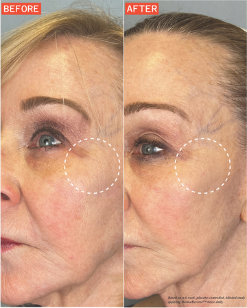 DermaReverse™