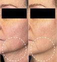 DermaReverse™: Clinically-Proven Skincare for GLP-1 Users